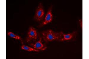Immunofluorescence (IF) image for anti-Catenin, beta (CATNB) (N-Term), (pSer33) antibody (ABIN7300586)