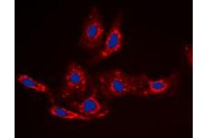Immunofluorescent analysis of Beta-catenin (pS33) staining in HepG2 cells. (beta Catenin Antikörper  (N-Term, pSer33))