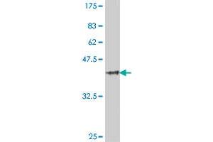 Western Blot detection against Immunogen (39. (TLR5 Antikörper  (AA 517-634))