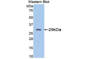 Detection of Recombinant AFP, Mouse using Polyclonal Antibody to Alpha-Fetoprotein (AFP) (alpha Fetoprotein Antikörper  (AA 399-605))