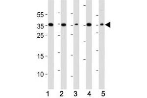 Western blot analysis of lysate from (1) A549, (2) HeLa, (3) HepG2, (4) Jurkat, (5) mouse NIH3T3 cell line using DKK1 antibody. (DKK1 Antikörper)