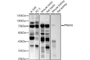 Western blot analysis of extracts of various cell lines, using PPM1G antibody (ABIN7269696) at 1:500 dilution. (PPM1G Antikörper)