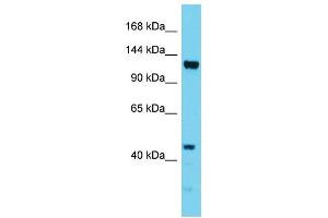 Host: Rabbit Target Name: EFTUD1 Sample Type: HepG2 Whole Cell lysates Antibody Dilution: 1.
