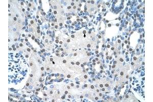 YWHAQ antibody was used for immunohistochemistry at a concentration of 4-8 ug/ml to stain Epithelial cells of renal tubule (arrows) in Human Kidney. (14-3-3 theta Antikörper  (N-Term))