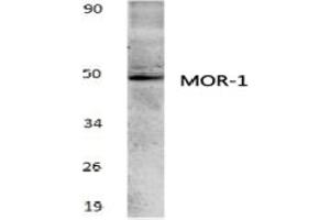 Image no. 1 for anti-Opioid Receptor, mu 1 (OPRM1) antibody (ABIN317766)