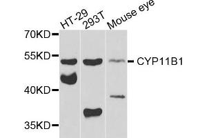 Western blot analysis of extracts of various cells, using CYP11B1 antibody. (CYP11B1 Antikörper)