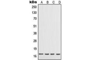 Western blot analysis of IL-17 expression in A20 (A), THP1 (B), Raw264. (IL-17 Antikörper  (Center))