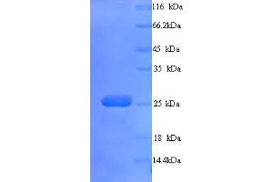 SDS-PAGE (SDS) image for butyrophilin, Subfamily 3, Member A3 (BTN3A3) (AA 30-248) protein (His tag) (ABIN5713292) (BTN3A3 Protein (AA 30-248) (His tag))