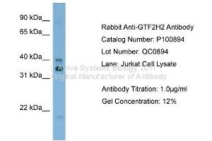 Western Blotting (WB) image for anti-General Transcription Factor IIH, Polypeptide 2, 44kDa (GTF2H2) (C-Term) antibody (ABIN2792641)
