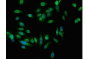 Immunofluorescent analysis of Hela cells using ABIN7151326 at dilution of 1:100 and Alexa Fluor 488-congugated AffiniPure Goat Anti-Rabbit IgG(H+L)