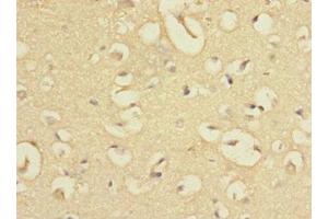 Immunohistochemistry of paraffin-embedded human brain tissue using ABIN7165334 at dilution of 1:100 (EVI2A Antikörper  (AA 31-133))