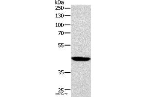 Western blot analysis of Human lymphoma tissue, using SOX7 Polyclonal Antibody at dilution of 1:1100 (SOX7 Antikörper)