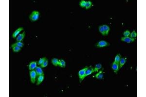 Immunofluorescent analysis of HepG2 cells using ABIN7154727 at dilution of 1:100 and Alexa Fluor 488-congugated AffiniPure Goat Anti-Rabbit IgG(H+L) (GNA11 Antikörper  (AA 1-359))