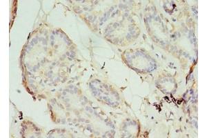 Immunohistochemistry of paraffin-embedded human breast cancer using ABIN7170565 at dilution of 1:100 (S1PR1 Antikörper  (AA 311-382))