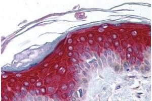 Human Skin (formalin-fixed, paraffin-embedded) stained with RPS6KA1 antibody ABIN213975 at 5 ug/ml followed by biotinylated goat anti-rabbit IgG secondary antibody ABIN481713, alkaline phosphatase-streptavidin and chromogen. (RPS6KA1 Antikörper  (N-Term))