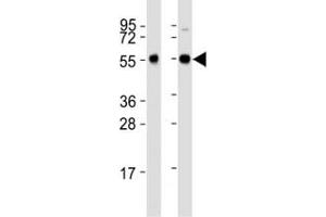 Western blot testing of Beclin-1 antibody at 1:2000 dilution. (Beclin 1 Antikörper  (AA 388-421))