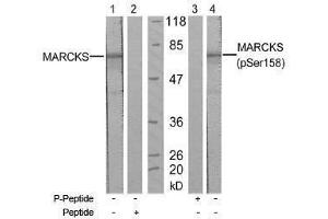 Image no. 1 for anti-Myristoylated Alanine-Rich Protein Kinase C Substrate (MARCKS) (pSer158) antibody (ABIN197065) (MARCKS Antikörper  (pSer158))