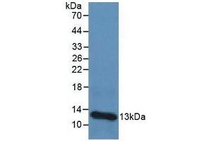 Detection of b2M in Human Urine Tissue using Polyclonal Antibody to Beta-2-Microglobulin (b2M)