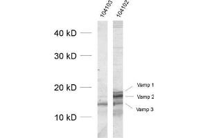 dilution: 1 : 1000, sample: crude synaptosomal fraction of rat brain (P2) (VAMP1, 2, 3 (AA 1-81) Antikörper)