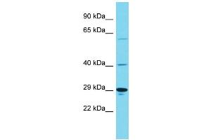 Host: Rabbit Target Name: KIAA1919 Sample Type: Hela Whole Cell lysates Antibody Dilution: 1.