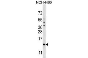 SMCP Antibody (C-term) western blot analysis in NCI-H460 cell line lysates (35µg/lane).