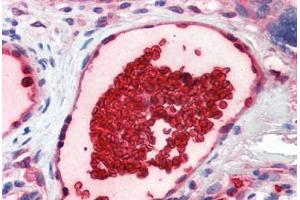 Human Placenta, Vessel with Erythrocytes (formalin-fixed, paraffin-embedded) stained with GYPA antibody ABIN337240 at 5 ug/ml followed by biotinylated goat anti-rabbit IgG secondary antibody ABIN481713, alkaline phosphatase-streptavidin and chromogen. (CD235a/GYPA Antikörper  (N-Term))