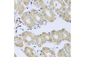 Immunohistochemistry of paraffin-embedded human stomach using SYT4 antibody (ABIN5975174) at dilution of 1/100 (40x lens). (SYT4 Antikörper)