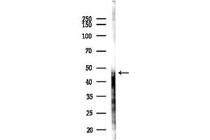 Western blot analysis of lysates from HUVEC cells(UV,30 min treatment), using  Antibody at 1/1000 dilution.