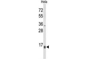 Western blot analysis of NPW Antibody (C-term) in Hela cell line lysates (35µg/lane). (NPW Antikörper  (C-Term))