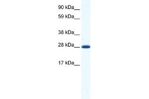 WB Suggested Anti-DLX4 Antibody Titration:  1. (DLX4 Antikörper  (N-Term))