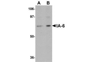 Western blot analysis of IA-6 in rat thymus tissue lysate with AP30397PU-N IA-6 antibody at (A) 1 and (B) 2 μg/ml. (INSM2 Antikörper  (C-Term))
