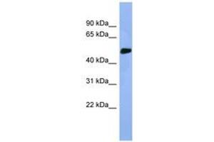 Image no. 1 for anti-serine/threonine Kinase 25 (STK25) (AA 274-323) antibody (ABIN6746292) (STK25 Antikörper  (AA 274-323))
