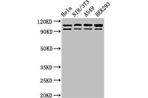 Western Blot Positive WB detected in: Hela whole cell lysate, NIH/3T3 whole cell lysate, A549 whole cell lysate, HEK293 whole cell lysate All lanes: MSH2 antibody at 2 μg/mL Secondary Goat polyclonal to rabbit IgG at 1/50000 dilution Predicted band size: 105, 98 kDa Observed band size: 105, 98 kDa (MSH2 Antikörper  (AA 2-254))