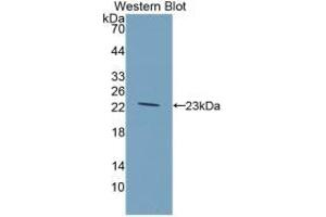 Detection of Recombinant GKRP, Rat using Monoclonal Antibody to Glucokinase Regulatory Protein (GKRP) (GCKR Antikörper  (AA 90-286))