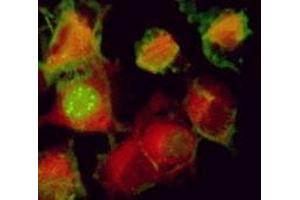 Immunofluorescence (IF) image for anti-Herpes Simplex Virus Type 1 ICP0 (HSV1 ICP0) antibody (ABIN265560) (HSV1 ICP0 Antikörper)