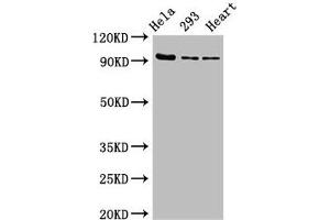 Western Blot Positive WB detected in: Hela whole cell lysate, 293 whole cell lysate, Rat heart tissue All lanes: MCM4 antibody at 2. (MCM4 Antikörper  (AA 2-141))