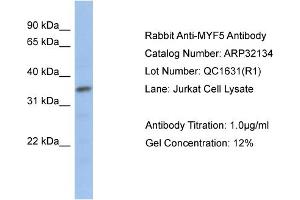 Western Blotting (WB) image for anti-Myogenic Factor 5 (MYF5) (N-Term) antibody (ABIN182493) (MYF5 Antikörper  (N-Term))