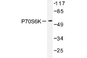 Image no. 1 for anti-Ribosomal Protein S6 Kinase, 70kDa, Polypeptide 1 (RPS6KB1) antibody (ABIN272051) (RPS6KB1 Antikörper)