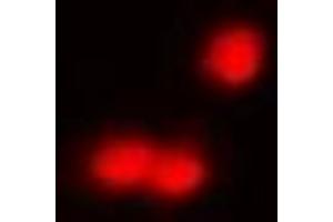 Immunofluorescent analysis of IRF8 staining in A549 cells. (IRF8 Antikörper)