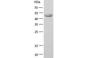 Western Blotting (WB) image for Forkhead Box D3 (FOXD3) (AA 2-478) protein (His tag) (ABIN7122992)