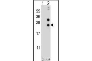 Western blot analysis of CSN1S1 (arrow) using rabbit polyclonal CSN1S1 Antibody (Center) (ABIN656838 and ABIN2846046). (Casein alpha S1 Antikörper  (AA 36-65))