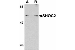 Image no. 1 for anti-Leucine-rich repeat protein SHOC-2 (SHOC2) (N-Term) antibody (ABIN478033) (SHoc2/Sur8 Antikörper  (N-Term))