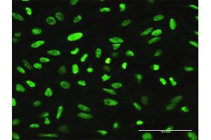 Immunofluorescence of purified MaxPab antibody to XRCC1 on HeLa cell. (XRCC1 Antikörper  (AA 1-633))