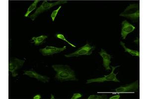 Immunofluorescence of monoclonal antibody to PCBP2 on HeLa cell.