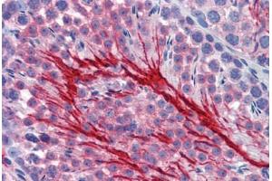 Mouse Testis (formalin-fixed, paraffin-embedded) stained with BSG antibody ABIN462349 followed by biotinylated secondary antibody, alkaline phosphatase-streptavidin and chromogen. (CD147 Antikörper)