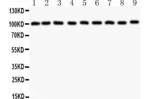 Anti-CBL Picoband antibody, All lanes: Anti-CBL at 0. (CBL Antikörper  (AA 556-906))