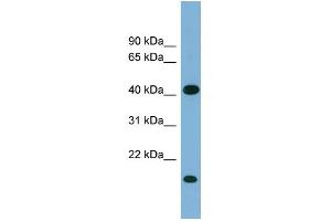 WB Suggested Anti-BXDC2 Antibody Titration: 0. (BRIX1 Antikörper  (Middle Region))