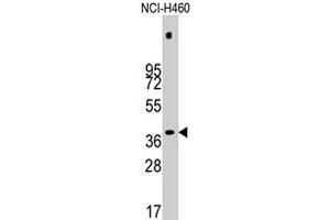 Western blot analysis of PDHX polyclonal antibody  in NCI-H460 cell line lysates (35 ug/lane). (PDHX Antikörper  (Thr11))