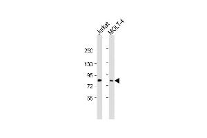 All lanes : Anti-LCP2 Antibody (Center) at 1:2000 dilution Lane 1: Jurkat whole cell lysate Lane 2: MOLT-4 whole cell lysate Lysates/proteins at 20 μg per lane.