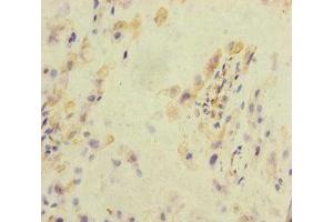 Immunohistochemistry of paraffin-embedded human placenta tissue using ABIN7157289 at dilution of 1:100 (KLHL26 Antikörper  (AA 366-615))